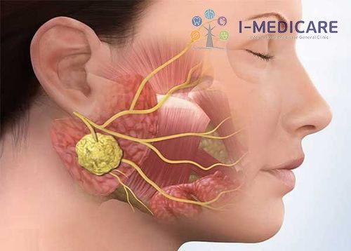 Siêu âm doppler u tuyến hạch vùng cổ