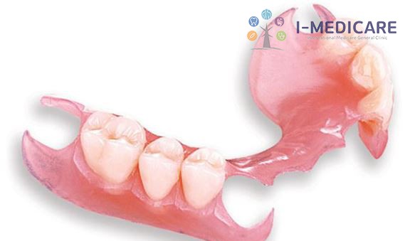 Hàm giả tháo lắp bán phần nền nhựa thường