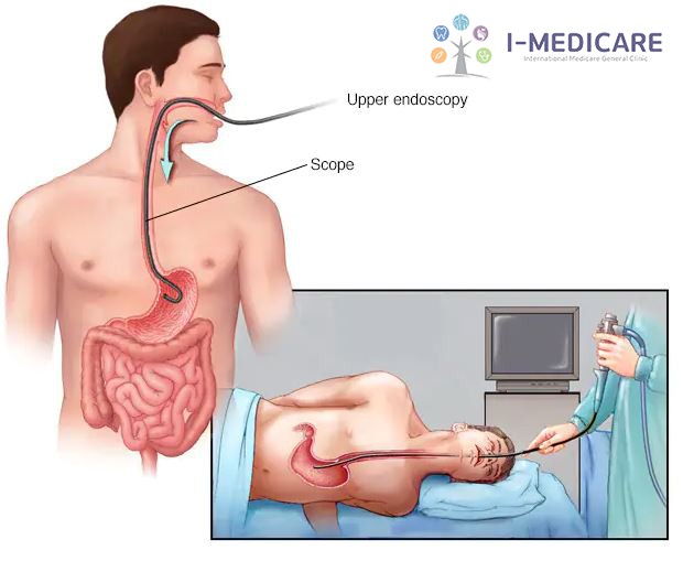 nội soi thực quản - dạ dày, lấy dị vật
