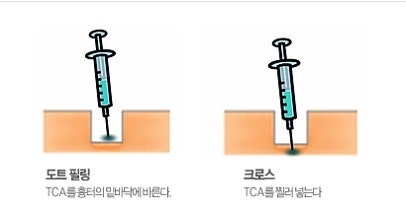 도트필링(CROSS)
