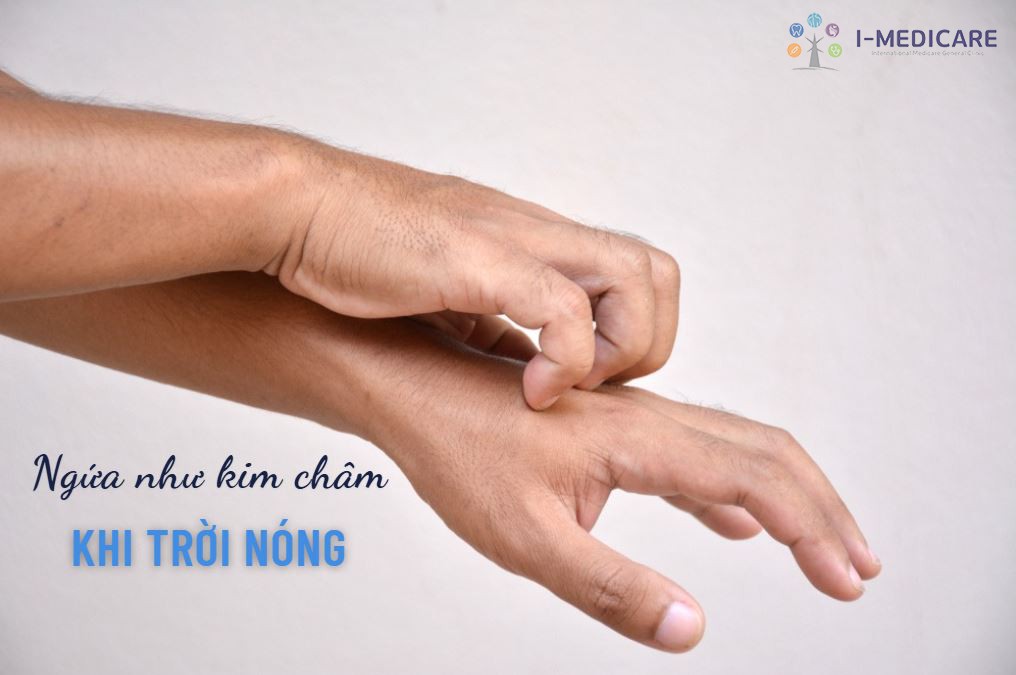 Ngứa như kim châm khi trời nóng: Các nguyên nhân và cách xử lý