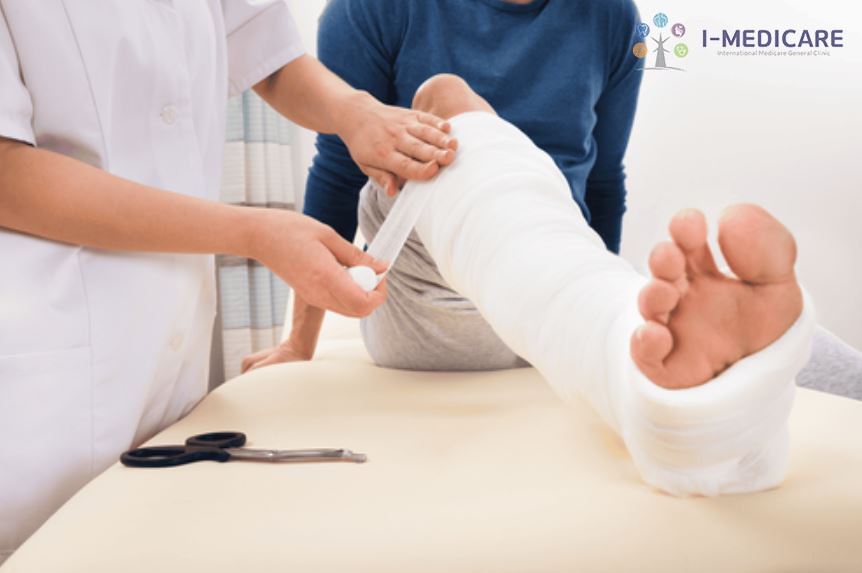 Tháo bột bao lâu thì hết sưng? Cảnh báo các dấu hiệu bất thường